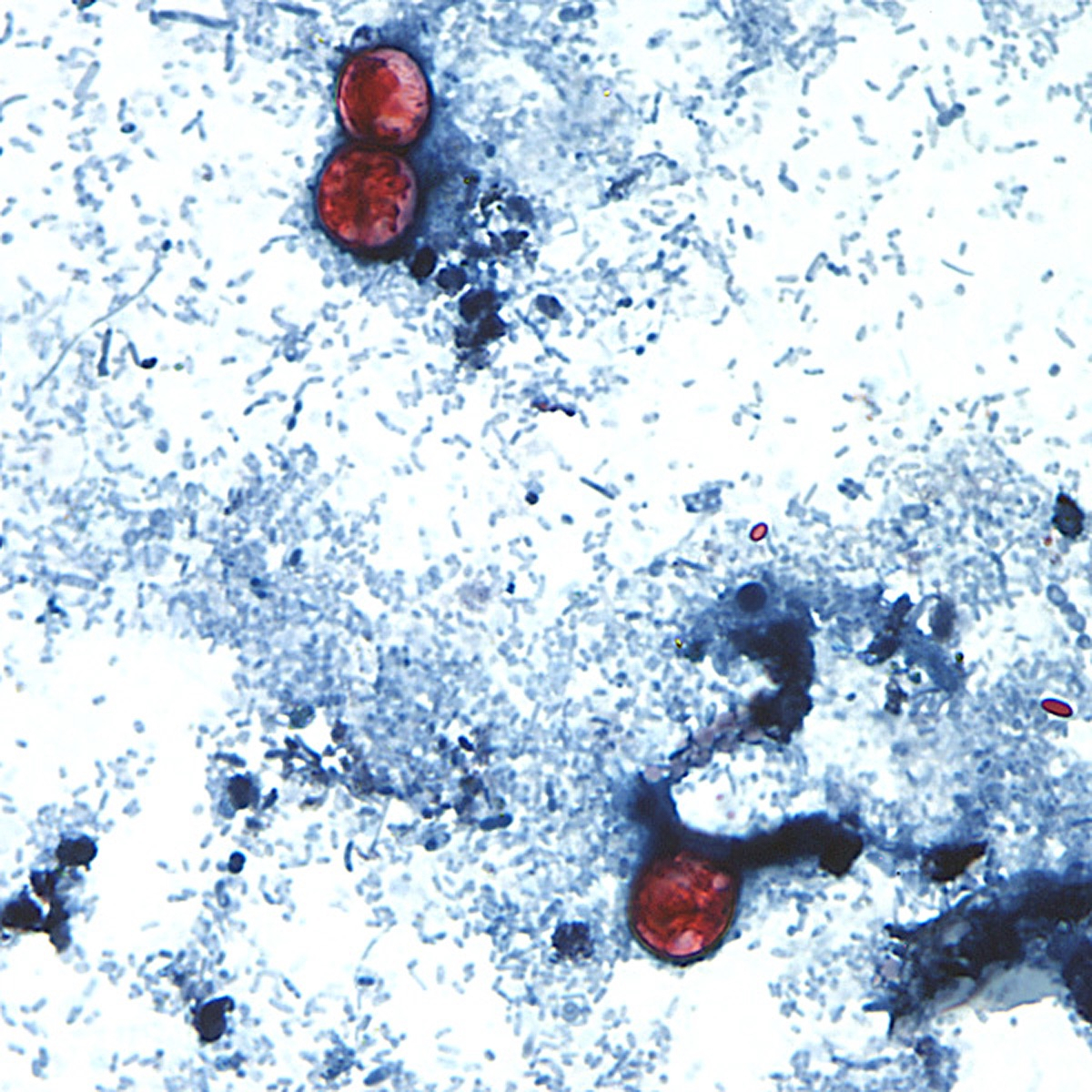 Taylor Farms recalls lettuce shipped to 27 states over cyclospora risk