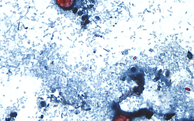 Taylor Farms recalls lettuce shipped to 27 states over cyclospora risk